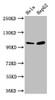 Western Blot<br />
 Positive WB detected in: Hela whole cell lysate, HepG2 whole cell lysate<br />
 All lanes: CTNNA1 antibody at 3.3µg/ml<br />
 Secondary<br />
 Goat polyclonal to rabbit IgG at 1/50000 dilution<br />
 Predicted band size: 101, 103, 60 kDa<br />
 Observed band size: 101 kDa<br />