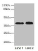 Western blot<br />
 All lanes: CTSL antibody at 12µg/ml<br />
 Lane 1: A549 whole cell lysate<br />
 Lane 2: HepG2 whole cell lysate<br />
 Secondary<br />
 Goat polyclonal to rabbit IgG at 1/10000 dilution<br />
 Predicted band size: 38 kDa<br />
 Observed band size: 38 kDa<br />