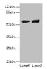 Western blot<br />
 All lanes: CYP17A1 antibody at 12µg/ml<br />
 Lane 1: Hela whole cell lysate<br />
 Lane 2: A549 whole cell lysate<br />
 Secondary<br />
 Goat polyclonal to rabbit IgG at 1/10000 dilution<br />
 Predicted band size: 58 kDa<br />
 Observed band size: 58 kDa<br />