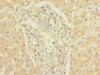 Immunohistochemistry of paraffin-embedded human liver tissue using CSB-PA006444LA01HU at dilution of 1:100