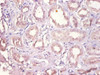 Immunohistochemistry of paraffin-embedded human kidney tissue using CSB-PA006867DA01HU at dilution of 1:100