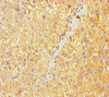 Immunohistochemistry of paraffin-embedded human liver tissue using CSB-PA00704A0Rb at dilution of 1:100