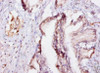 Immunohistochemistry of paraffin-embedded human prostate tissue using CSB-PA007563YA01HU at dilution of 1:10