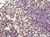 Immunohistochemistry of paraffin-embedded human spleen tissue using CSB-PA007587LA01HU at dilution of 1:100