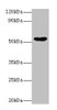 Western blot<br />
 All lanes: EPHX1 antibody at 2µg/ml + Hela whole cell lysate<br />
 Secondary<br />
 Goat polyclonal to rabbit IgG at 1/10000 dilution<br />
 Predicted band size: 53 kDa<br />
 Observed band size: 53 kDa<br /> Western blot<br />
 All lanes: EPHX1 antibody at 2µg/ml + Hela whole cell lysate<br />
 Secondary<br />
 Goat polyclonal to rabbit IgG at 1/10000 dilution<br />
 Predicted band size: 53 kDa<br />
 Observed band size: 53 kDa<br />