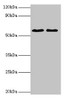 Western blot<br />
 All lanes: ESR2 antibody at 2µg/ml<br />
 Lane 1: Mouse brain tissue<br />
 Lane 2: PC-3 whole cell lysate<br />
 Secondary<br />
 Goat polyclonal to rabbit IgG at 1/10000 dilution<br />
 Predicted band size: 60, 56, 36, 58, 55, 53, 49, 42, 54 kDa<br />
 Observed band size: 60 kDa<br />