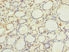 Immunohistochemistry of paraffin-embedded human thyroid tissue using CSB-PA007850LA01HU at dilution of 1:100