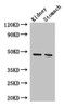 Western Blot<br />
 Positive WB detected in: Mouse kidney tissue, Mouse stomach tissue<br />
 All lanes: FAH antibody at 3.4µg/ml<br />
 Secondary<br />
 Goat polyclonal to rabbit IgG at 1/50000 dilution<br />
 Predicted band size: 47, 39 kDa<br />
 Observed band size: 47 kDa<br />