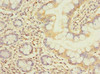 Immunohistochemistry of paraffin-embedded human small intestine tissue using CSB-PA008549LA01HU at dilution of 1:100