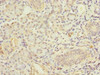 Immunohistochemistry of paraffin-embedded human pancreatic tissue using CSB-PA008549LA01HU at dilution of 1:100