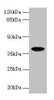 Western blot<br />
 All lanes: FPR2 antibody at 8µg/ml + HL60 whole cell lysate<br />
 Secondary<br />
 Goat polyclonal to rabbit IgG at 1/10000 dilution<br />
 Predicted band size: 39 kDa<br />
 Observed band size: 39 kDa<br />