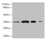 Western blot<br />
 All lanes: SULT1A3 antibody at 20µg/ml<br />
 Lane 1: A549 whole cell lysate<br />
 Lane 2: Colo320 whole cell lysate<br />
 Lane 3: Mouse brain tissue<br />
 Lane 4: Mouse kidney tissue<br />
 Secondary<br />
 Goat polyclonal to rabbit IgG at 1/10000 dilution<br />
 Predicted band size: 35, 23 kDa<br />
 Observed band size: 35 kDa<br />