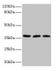 Western blot<br />
 All lanes: FTSJ1 antibody at 2µg/ml<br />
 Lane 1: HepG2 whole cell lysate<br />
 Lane 2: Mouse brain tissue<br />
 Lane 3: EC109 whole cell lysate<br />
 Secondary<br />
 Goat polyclonal to rabbit IgG at 1/15000 dilution<br />
 Predicted band size: 37, 36 kDa<br />
 Observed band size: 37 kDa<br />