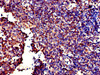 Immunohistochemistry of paraffin-embedded human tonsil tissue using CSB-PA009226LA01HU at dilution of 1:100
