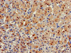 Immunohistochemistry of paraffin-embedded human adrenal gland tissue using CSB-PA009226LA01HU at dilution of 1:100