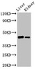 Western Blot<br />
 Positive WB detected in: Rat liver tissue, Mouse kidney tissue<br />
 All lanes: GALT antibody at 3µg/ml<br />
 Secondary<br />
 Goat polyclonal to rabbit IgG at 1/50000 dilution<br />
 Predicted band size: 44, 32 kDa<br />
 Observed band size: 44 kDa<br />