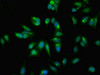 Immunofluorescent analysis of Hela cells using CSB-PA009226LA01HU at dilution of 1:100 and Alexa Fluor 488-congugated AffiniPure Goat Anti-Rabbit IgG (H+L)
