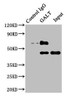 Immunoprecipitating GALT in HepG2 whole cell lysate<br />
 Lane 1: Rabbit control IgG instead of CSB-PA009226LA01HU in HepG2 whole cell lysate.
 For western blotting, a HRP-conjugated Protein G antibody was used as the secondary antibody (1/2000) <br />
 Lane 2: CSB-PA009226LA01HU (8µg) + HepG2 whole cell lysate (500µg) <br />
 Lane 3: HepG2 whole cell lysate (10µg) <br />