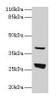 Western blot<br />
 All lanes: Gamt antibody at 2µg/ml + Rat liver tissue<br />
 Secondary<br />
 Goat polyclonal to rabbit IgG at 1/10000 dilution<br />
 Predicted band size: 27 kDa<br />
 Observed band size: 27 kDa<br />