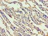 Immunohistochemistry of paraffin-embedded human lung tissue using CSB-PA009417LA01HU at dilution of 1:100