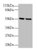 Western blot<br />
 All lanes: GDI2 antibody at 2µg/ml<br />
 Lane 1: 293T whole cell lysate<br />
 Lane 2: EC109 whole cell lysate<br />
 Secondary<br />
 Goat polyclonal to rabbit IgG at 1/15000 dilution<br />
 Predicted band size: 51, 46 kDa<br />
 Observed band size: 51 kDa<br />