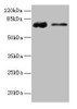 Western blot<br />
 All lanes: GLCE antibody at 12µg/ml<br />
 Lane 1: Rat liver tissue<br />
 Lane 2: Mouse kidney tissue<br />
 Secondary<br />
 Goat polyclonal to rabbit IgG at 1/10000 dilution<br />
 Predicted band size: 71 kDa<br />
 Observed band size: 71 kDa<br />