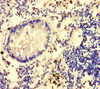 Immunohistochemistry of paraffin-embedded human appendix tissue using CSB-PA009492LA01HU at dilution of 1:100