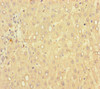 Immunohistochemistry of paraffin-embedded human liver tissue using CSB-PA009492LA01HU at dilution of 1:100