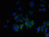 Immunofluorescent analysis of HepG2 cells using CSB-PA009503LA01HU at dilution of 1:100 and Alexa Fluor 488-congugated AffiniPure Goat Anti-Rabbit IgG (H+L)