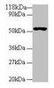 Western blot<br />
 All lanes: GLP1R antibody at 2µg/ml + 293T whole cell lysate<br />
 Secondary<br />
 Goat polyclonal to rabbit IgG at 1/10000 dilution<br />
 Predicted band size: 54 kDa<br />
 Observed band size: 54 kDa<br />