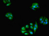 Immunofluorescent analysis of HepG2 cells using CSB-PA009521EA01HU at dilution of 1:100 and Alexa Fluor 488-congugated AffiniPure Goat Anti-Rabbit IgG (H+L)