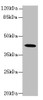 Western blot<br />
 All lanes: GNA14 antibody at 3µg/ml + Mouse lung tissue<br />
 Secondary<br />
 Goat polyclonal to rabbit IgG at 1/10000 dilution<br />
 Predicted band size: 42 kDa<br />
 Observed band size: 42 kDa<br />