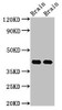 Western Blot<br />
 Positive WB detected in: Rat brain tissue, Mouse brain tissue<br />
 All lanes: Gnao1 antibody at 3µg/ml<br />
 Secondary<br />
 Goat polyclonal to rabbit IgG at 1/50000 dilution<br />
 Predicted band size: 41 kDa<br />
 Observed band size: 41 kDa<br />
