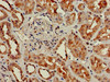 Immunohistochemistry of paraffin-embedded human kidney tissue using CSB-PA009616LA01HU at dilution of 1:100