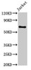 Western Blot<br />
 Positive WB detected in: Jurkat whole cell lysate<br />
 All lanes: GNL1 antibody at 3.2µg/ml<br />
 Secondary<br />
 Goat polyclonal to rabbit IgG at 1/50000 dilution<br />
 Predicted band size: 69, 48 kDa<br />
 Observed band size: 69 kDa<br />