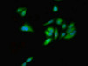 Immunofluorescent analysis of Hela cells using CSB-PA009623LA01HU at dilution of 1:100 and Alexa Fluor 488-congugated AffiniPure Goat Anti-Rabbit IgG (H+L)