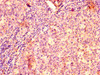 IHC image of CSB-PA00969A0Rb diluted at 1:500 and staining in paraffin-embedded human tonsil tissue performed on a Leica BondTM system. After dewaxing and hydration, antigen retrieval was mediated by high pressure in a citrate buffer (pH 6.0) . Section was blocked with 10% normal goat serum 30min at RT. Then primary antibody (1% BSA) was incubated at 4°C overnight. The primary is detected by a biotinylated secondary antibody and visualized using an HRP conjugated SP system.
