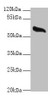Western blot<br />
 All lanes: GPC4 antibody at 8µg/ml + Mouse brain tissue<br />
 Secondary<br />
 Goat polyclonal to rabbit IgG at 1/10000 dilution<br />
 Predicted band size: 63, 55 kDa<br />
 Observed band size: 63 kDa<br />