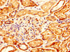 IHC image of CSB-PA009708LA01HU diluted at 1:300 and staining in paraffin-embedded human kidney tissue performed on a Leica BondTM system. After dewaxing and hydration, antigen retrieval was mediated by high pressure in a citrate buffer (pH 6.0) . Section was blocked with 10% normal goat serum 30min at RT. Then primary antibody (1% BSA) was incubated at 4°C overnight. The primary is detected by a biotinylated secondary antibody and visualized using an HRP conjugated SP system.