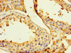 Immunohistochemistry of paraffin-embedded human testis tissue using CSB-PA009711LA01HU at dilution of 1:100