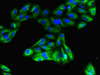 Immunofluorescent analysis of HepG2 cells using CSB-PA009792LA01HU at dilution of 1:100 and Alexa Fluor 488-congugated AffiniPure Goat Anti-Rabbit IgG (H+L)