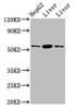 Western Blot<br />
 Positive WB detected in: HepG2 whole cell lysate, Rat liver tissue, Mouse liver tissue<br />
 All lanes: GPT antibody at 4.5µg/ml<br />
 Secondary<br />
 Goat polyclonal to rabbit IgG at 1/50000 dilution<br />
 Predicted band size: 55 kDa<br />
 Observed band size: 55 kDa<br />