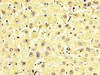 IHC image of CSB-PA009864LA01HU diluted at 1:350 and staining in paraffin-embedded human liver tissue performed on a Leica BondTM system. After dewaxing and hydration, antigen retrieval was mediated by high pressure in a citrate buffer (pH 6.0) . Section was blocked with 10% normal goat serum 30min at RT. Then primary antibody (1% BSA) was incubated at 4°C overnight. The primary is detected by a biotinylated secondary antibody and visualized using an HRP conjugated SP system.