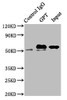 Immunoprecipitating GPT in Mouse liver tissue<br />
 Lane 1: Rabbit control IgG instead of CSB-PA009864LA01HU in Mouse liver tissue.
 For western blotting, a HRP-conjugated Protein G antibody was used as the secondary antibody (1/2000) <br />
 Lane 2: CSB-PA009864LA01HU (8µg) + Mouse liver tissue (500µg) <br />
 Lane 3: Mouse liver tissue (10µg) <br />