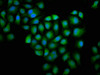 Immunofluorescence staining of Hela cells with CSB-PA009965HA01HU at 1:100, counter-stained with DAPI. The cells were fixed in 4% formaldehyde, permeabilized using 0.2% Triton X-100 and blocked in 10% normal Goat Serum. The cells were then incubated with the antibody overnight at 4°C. The secondary antibody was Alexa Fluor 488-congugated AffiniPure Goat Anti-Rabbit IgG (H+L) .