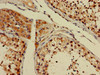 Immunohistochemistry of paraffin-embedded human testis tissue using CSB-PA009991LA01HU at dilution of 1:100