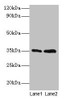 Western blot<br />
 All lanes: GTF2B antibody at 2µg/ml<br />
 Lane 1: HepG2 whole cell lysate<br />
 Lane 2: Hela whole cell lysate<br />
 Secondary<br />
 Goat polyclonal to rabbit IgG at 1/15000 dilution<br />
 Predicted band size: 35 kDa<br />
 Observed band size: 35 kDa<br />