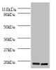 Western blot<br />
 All lanes: H2AFJ antibody at 2µg/ml<br />
 Lane 1: Mouse brain tissue<br />
 Lane 2: MCF-7 whole cell lysate<br />
 Secondary<br />
 Goat polyclonal to rabbit IgG at 1/10000 dilution<br />
 Predicted band size: 15, 17 kDa<br />
 Observed band size: 15 kDa<br />