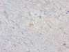 Immunohistochemistry of paraffin-embedded human tonsil tissue using CSB-PA010145LA01HU at dilution of 1:20