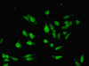 Immunofluorescent analysis of Hela cells using CSB-PA010244LA01HU at dilution of 1:100 and Alexa Fluor 488-congugated AffiniPure Goat Anti-Rabbit IgG (H+L)